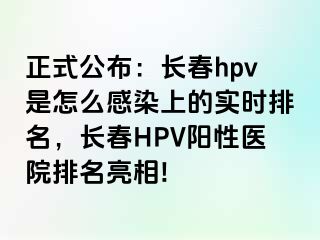 正式公布：长春hpv是怎么感染上的实时排名，长春HPV阳性医院排名亮相!