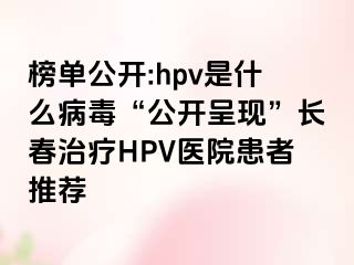 榜单公开:hpv是什么病毒“公开呈现”长春治疗HPV医院患者推荐