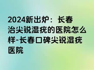 2024新出炉：长春治尖锐湿疣的医院怎么样-长春口碑尖锐湿疣医院